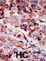IHC-P - AK2 Antibody (C-term) AP8134b